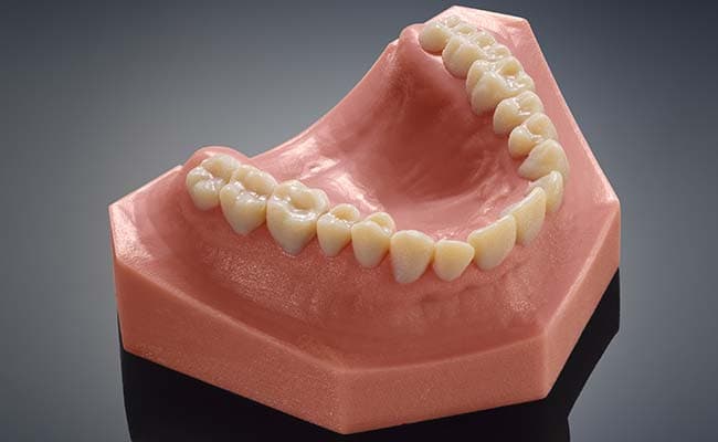 This dental replica was made using a 3D printer. Researchers are now working on ways to make those 3D-printed teeth resistant to bacteria. Image courtesy: Stratasys/The Washington Post