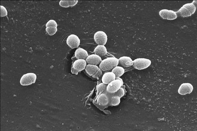 Antibiotic resistance: Sometimes bacterial infections become resistant to the antibiotic