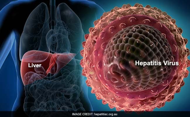 There are many new policies regarding organs infected with Hepatitis C