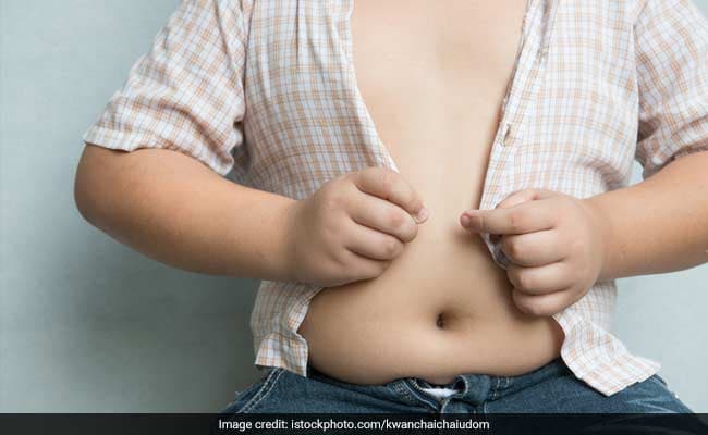 Childhood obesity can increase risk of osteoarthritis, says study