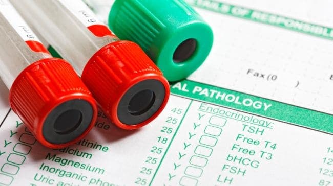 Analysis Of Blood Samples Reveal Molecular Differences Between Early, Pre-Term Deliveries